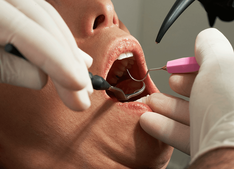 Dental Treatment